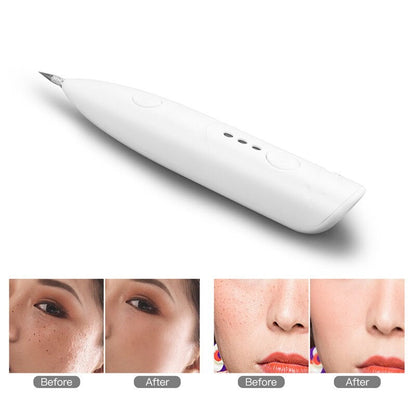 Electric Mini Laser Pen Tattoo Mole Removal Machine Face Care Skin Tag